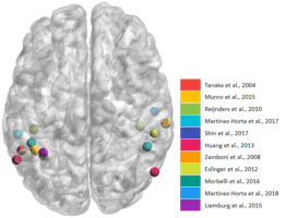 Brain image